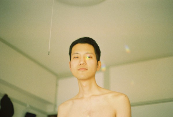 歯列矯正。